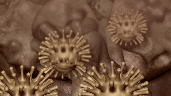 舌下腺囊肿的症状有哪些?(图1)