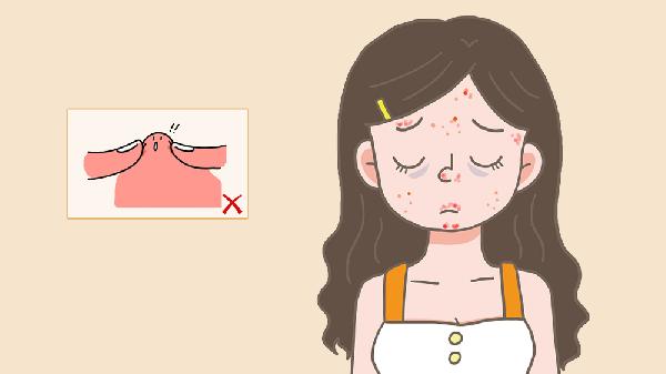 做冷冻治疗去痘疤手术时间是多久?(图1) 做冷冻治疗去痘疤手术时间是多久?(图1)