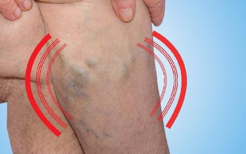 如何科学练腿？掌握正确时间和技巧很重要