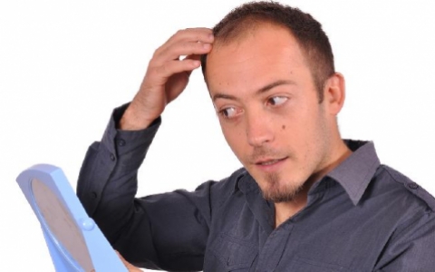 掉发脱发严重是什么原因