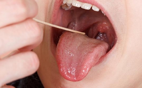 舌头下面好像断了怎么办