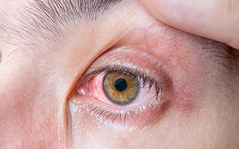 洗面奶泡沫弄到眼睛好痛怎么办