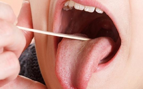 反流性喉炎会影响胸前痛