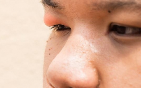 为什么眼睛下面经常黑黑的