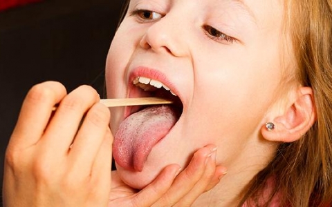 舌头上白白的是积食了吗