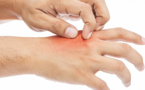 身上出现划痕也没挠是什么原因