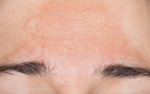 身上有越来越多的黑点吗？