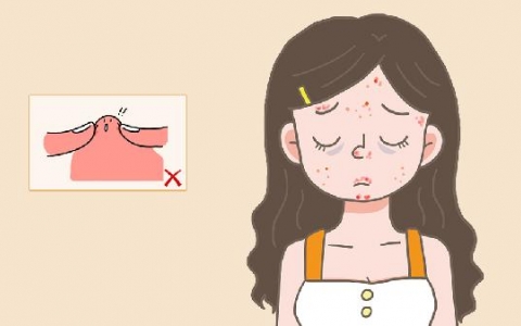 女性外面长了一个痘痘