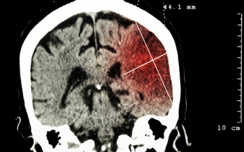 性病会影响生育健康吗？常见性病对生育系统有哪些危害？