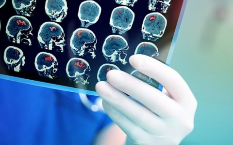 如何检查尿路感染