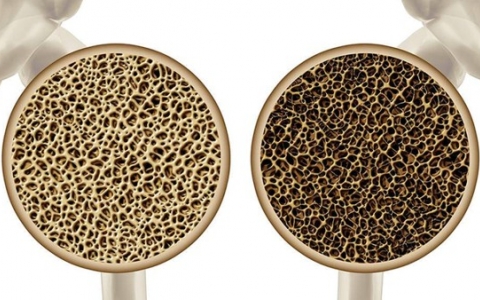 尿路感染的检查