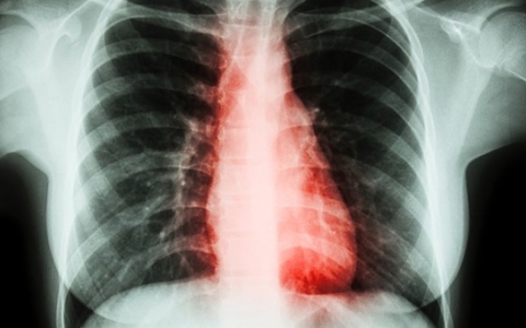 念珠菌感染后的检查