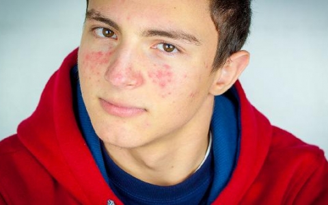 男性脸颊两侧发黑是怎么回事