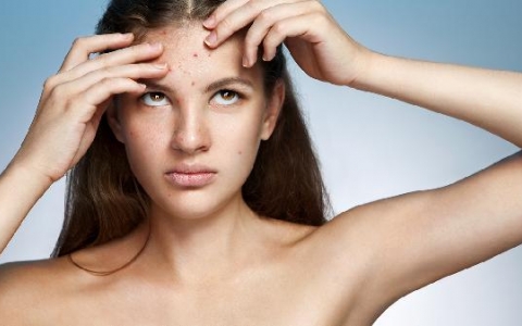 脸上出油是什么原因