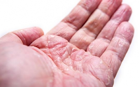 手指发凉发白是什么原因