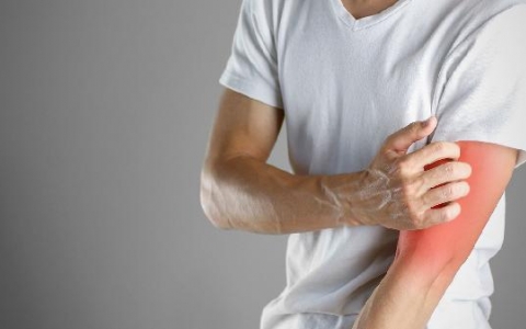 昨天胳膊上面怎么起了红点点