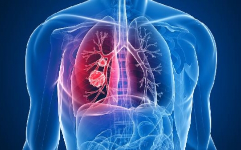 CIN3治好了能活几年