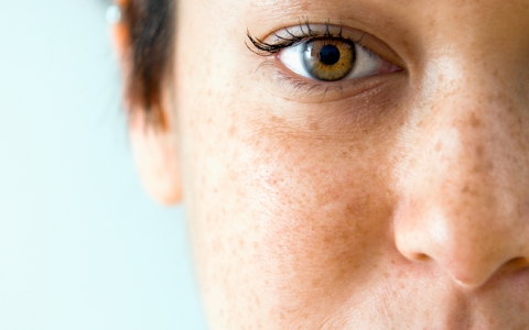 如何去除妊娠斑，妊娠斑会自己消失吗