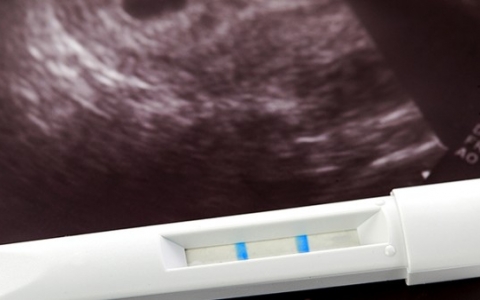 女性不孕受哪些因素影响 女性不孕不育需要做哪些检查