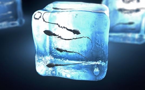 精子核染色检测精子畸形