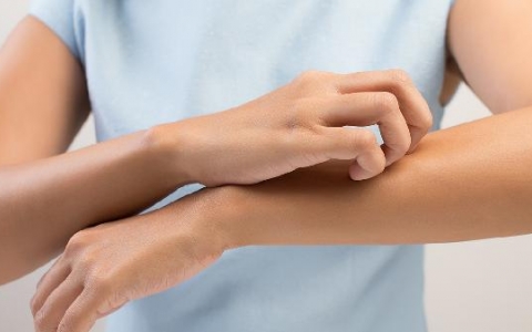 如何消除屁股红色丘疹