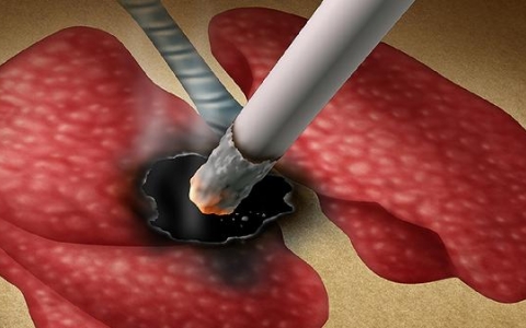 结节影和结节的区别有哪些呢