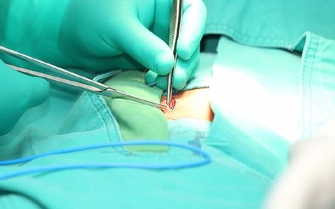 囊性结节怎么治疗