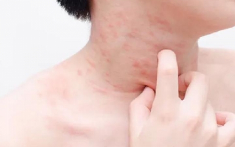 蒙氏结节凸起的原因