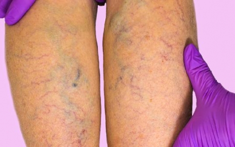 58岁走路感觉腿累