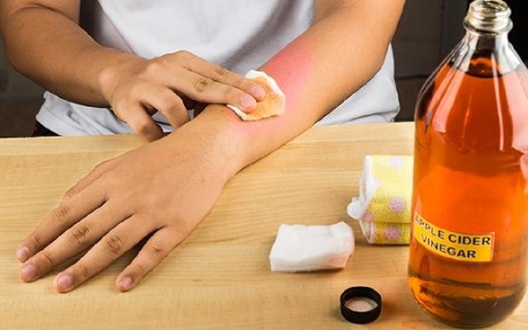 蜈蚣螫伤为什么不能用碘伏消毒