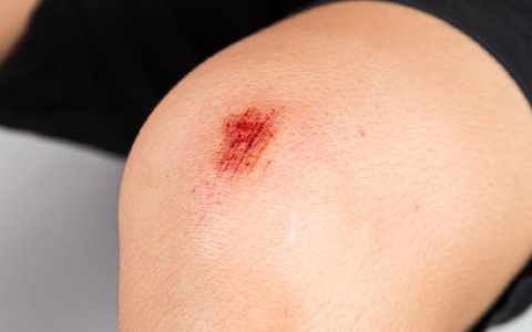 有伤口能喝酒吗