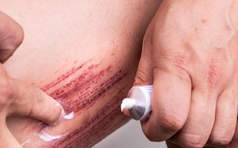 伤口出水是什么原因