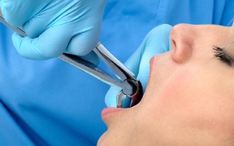 拔牙后吃什么食物有利于伤口愈合