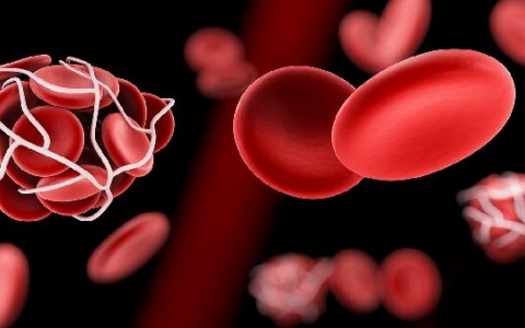 成人斯蒂尔病高烧怎么办