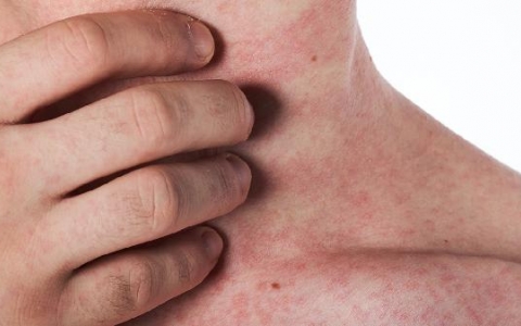 常年低烧是怎么回事