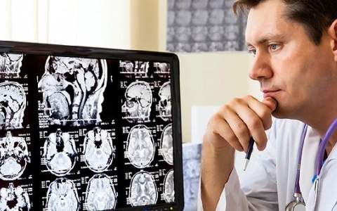 脑瘤的症状有哪些