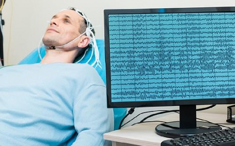 轻度脑梗死的病因是什么