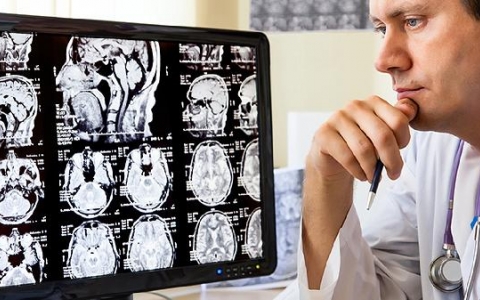 脑梗死的症状及预后