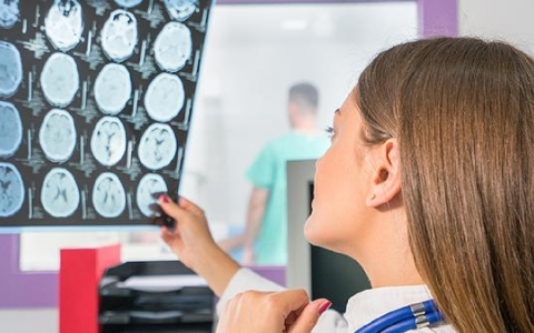 脑梗死为什么会误诊