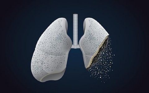 肺结节icu要观察多久