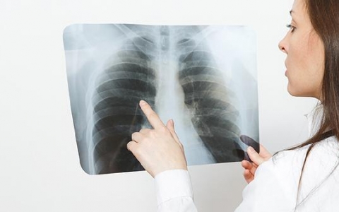 肺结节按压肋骨疼吗有事吗