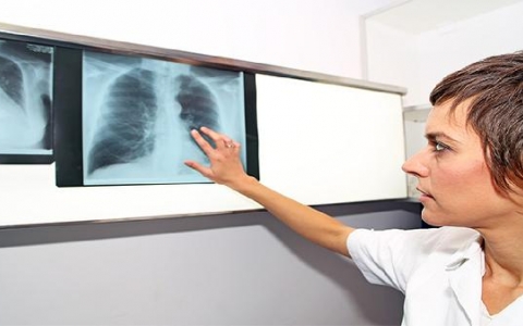 肺结节爱吐痰吗为什么呢