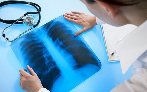 肺结节按照大小分类分为