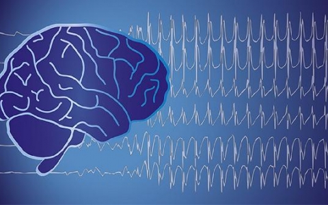 巨脑有哪些典型症状