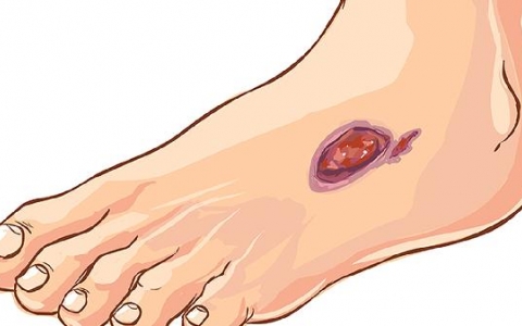 脚软手软是怎么回事