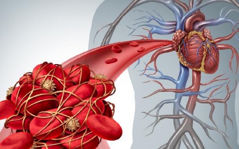 r波递增不良需要治疗吗？