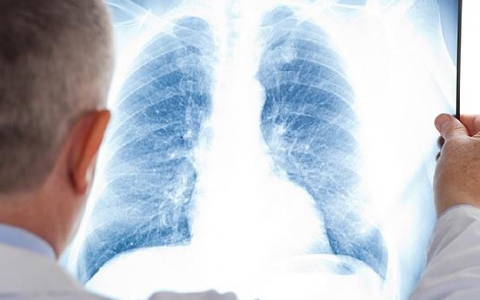 T波改变需要治疗吗