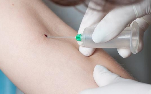 乳糜血的治疗方法有哪些