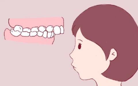 牙齿很正常可是地包天