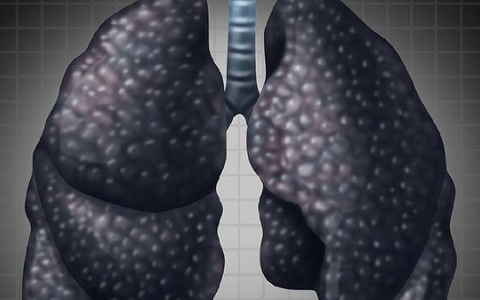 气管腺样囊性癌存活率